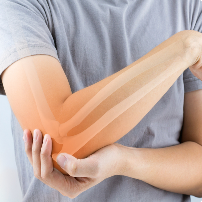 Tennis Elbow