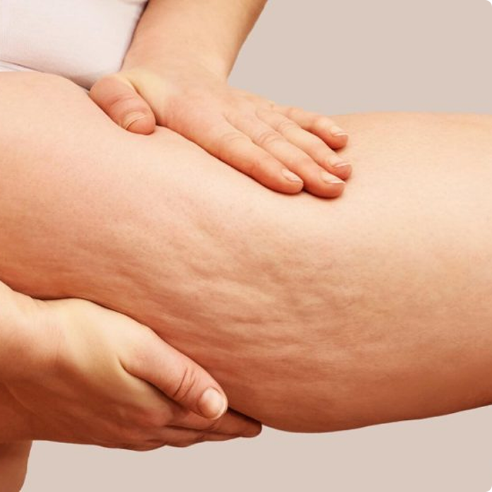 tirzepatide weight loss miami dadeland Tirzepatide in Miami: Up to 22% Body Weight Loss (Mounjaro/Zepbound)